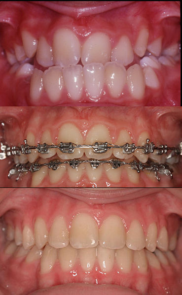Czym zajmuje się ortodoncja