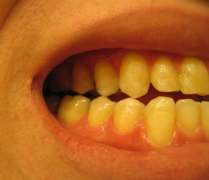 Czym zajmuje się periodontologia